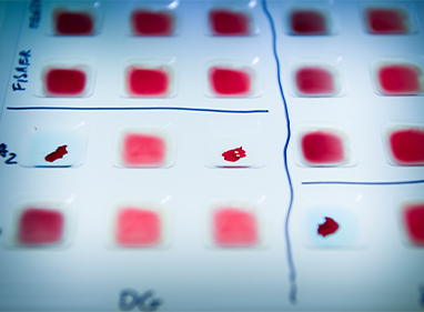 close up of a series of blood samples