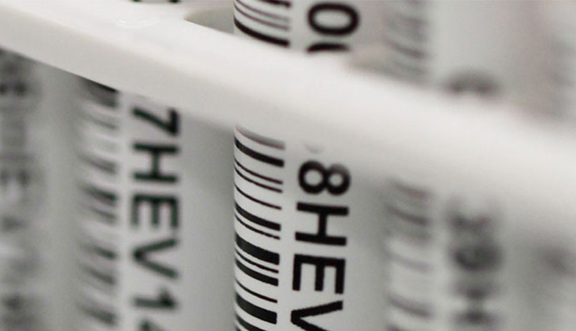 closeup of vials with HEV written on them